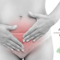 Az endometriózis hátterében 3. rész