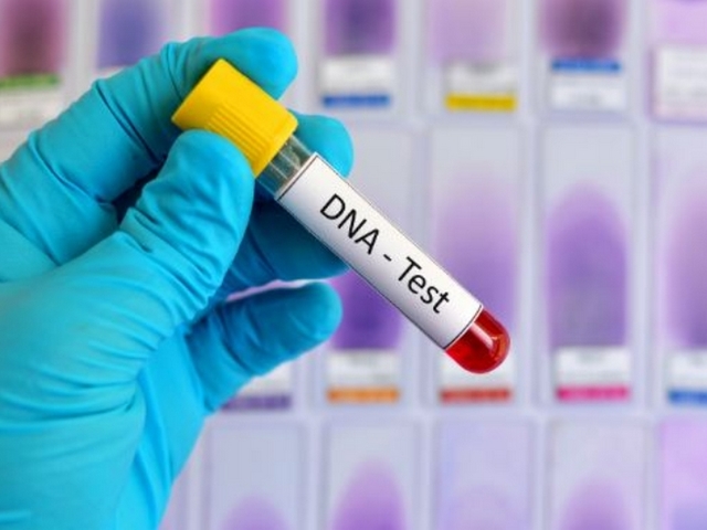 Rosszul sült el a poénból elvégeztetett DNS-teszt