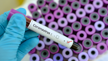 A koronavírus sokkal jobb sztori, mint a klímaváltozás