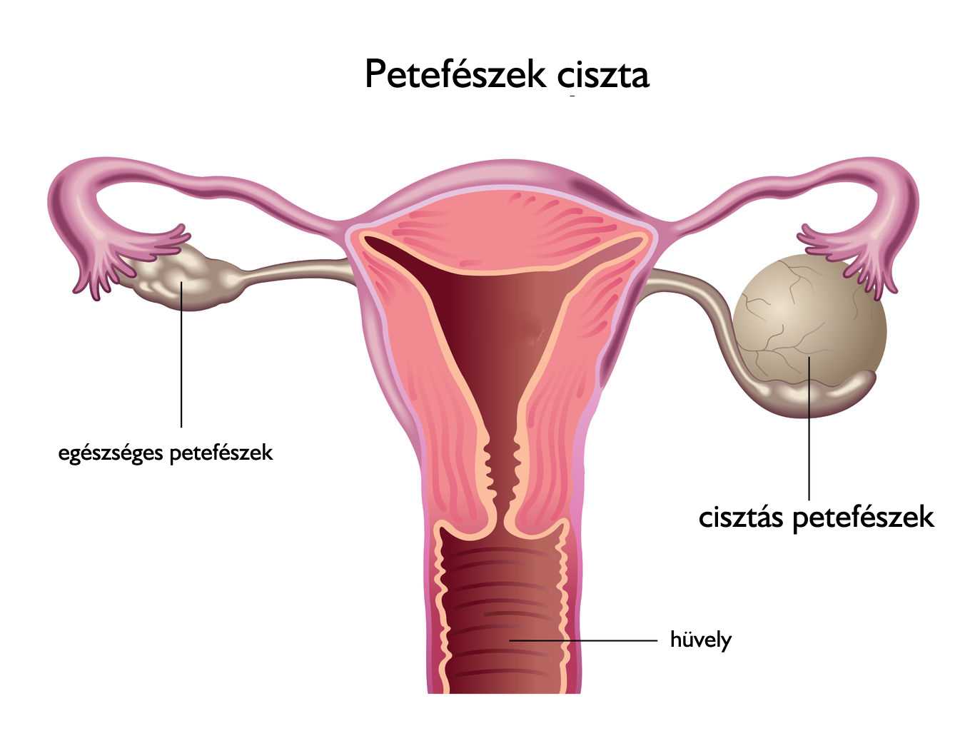 petefeszek-ciszta.jpg