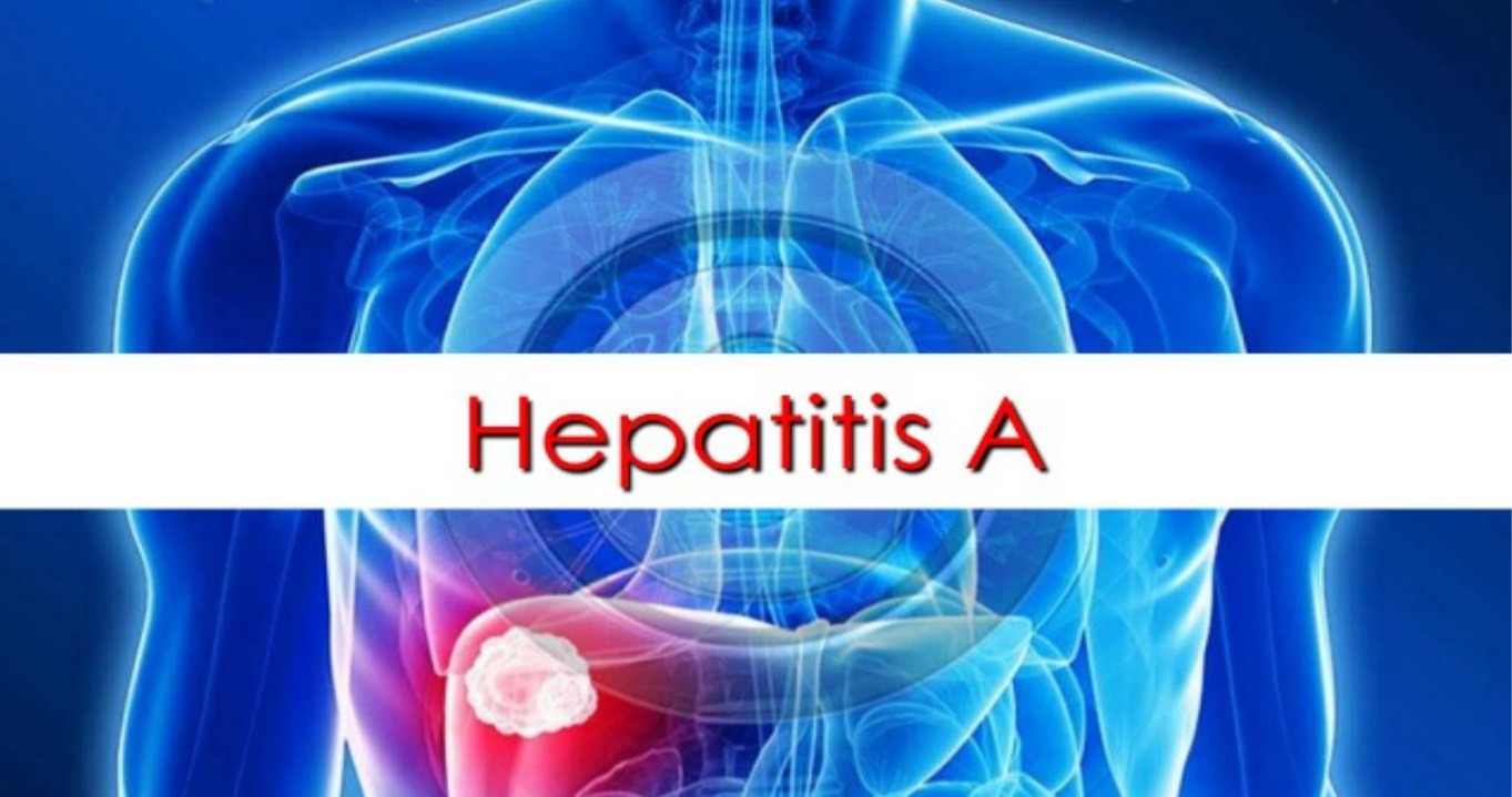 hepatitis-a.jpg