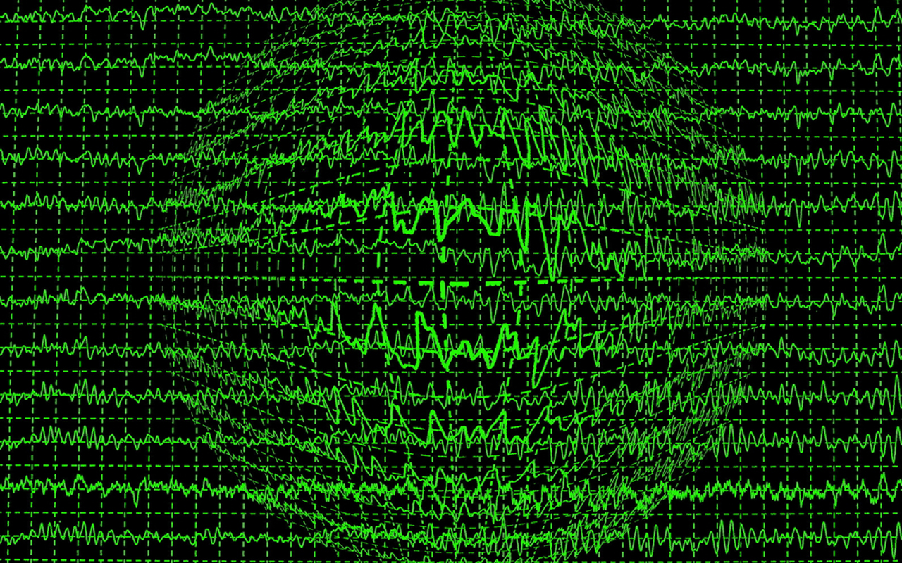 brain-wave-epilepsy-neuro.jpg