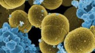 Gyulladáscsökkentő baktériumot találtak