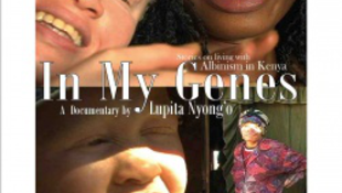 Durva film az albínó emberekről