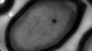Rejtélyes pandoravírusokat találtak