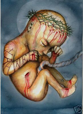 jesus-crucified-in-the-womb_1.jpg