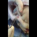 Bőrférgesség! Angol Bulldog "Harder" mirigy műtét utáni melléklelet.: Szúnyog által terjesztett Dirofilaria bőrféreg egy csomóból...