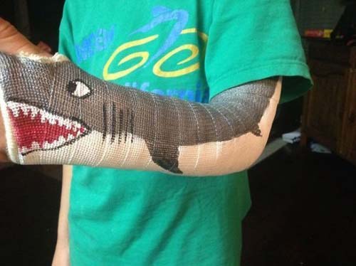 cast-art-shark.jpg