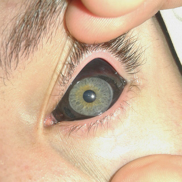 eyeball-tattoo-101.jpg