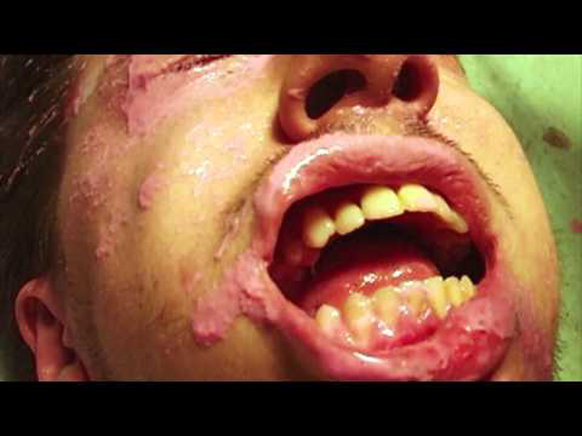 Idén bemutatják a Flaming Lips lemezéből készített musicalt