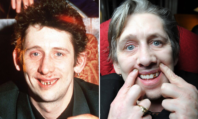 shane-macgowan-fog.jpg