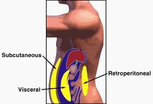 viszceralis-zsir.gif