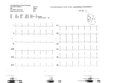 EKG 1.jpg