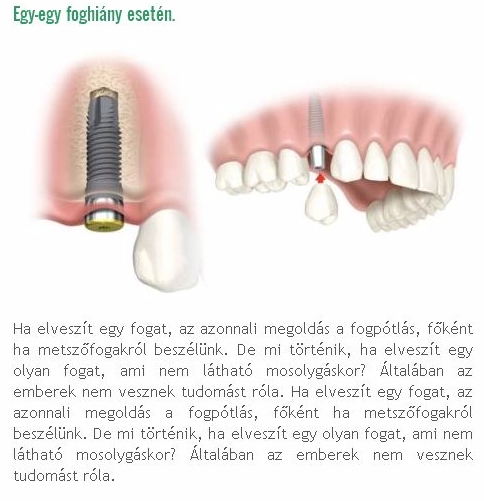 fogbeultetes_s.jpg