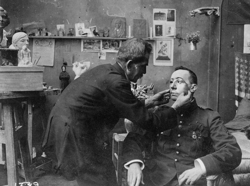 Megrázó képek az első világháború sebesült katonáinak arcprotéziseiről (18+)