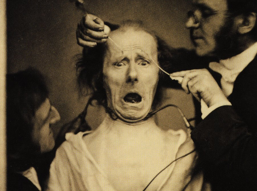 Duchenne, a fényképező orvos kísérletei (1852-1862)