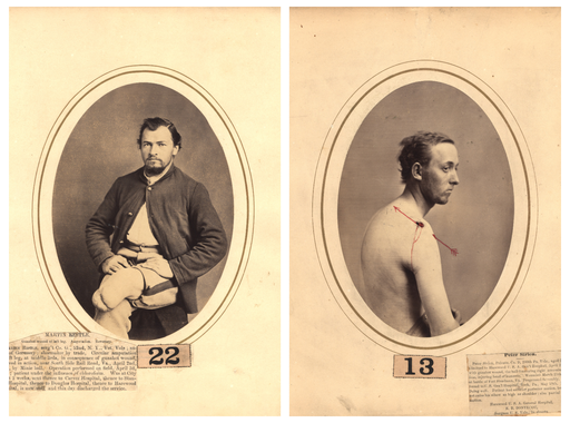Egy New York-i sebész képei polgárháborús sebesültekről