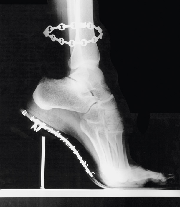 Fotó: Helmut Newton: Shoe X-Ray, 1994 Inkjet Print black/white, 2007 © Helmut Newton Estate