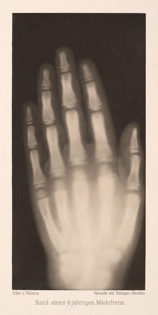 Fotó: Dr. Josef Maria Eder: Egy 8 éves kislány kézfeje, 1896