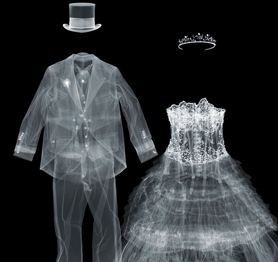 Fotó: Nick Veasey: Menyasszony és vőlegény © Nick Veasey / Caters / Picture Media 