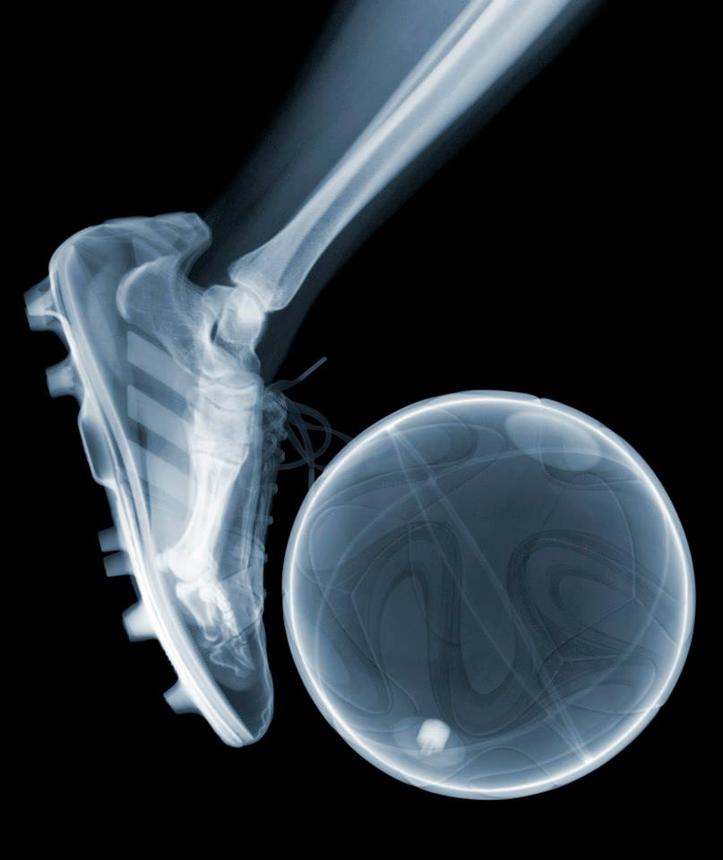 Fotó: Nick Veasey: World Cup, C-Type Print mounted on Plexi, 2014 © Nick Veasey