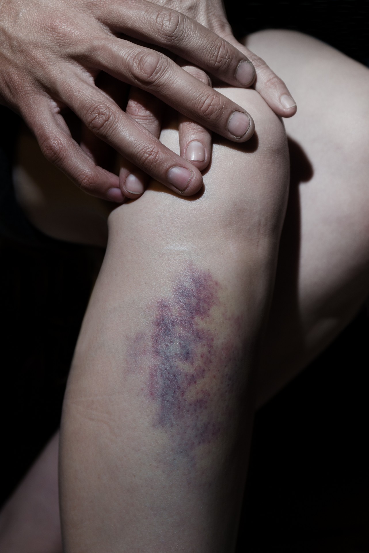 Fotó: Koleszár Adél: Rendőri verés, részlet Az erőszak sebei című sorozatból