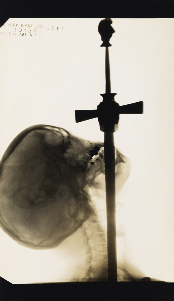 Fotó: Edward J. Kelty: Ajax, a kardnyelő röntgenképe, 1928 © Collection of Ken Harck