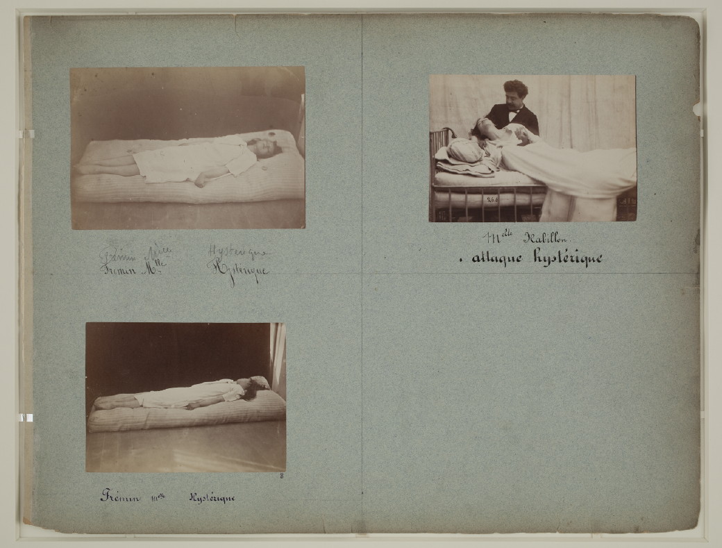 Fotó: Albert Londe: Charcot páciensei, Salpêtrière Kórház, Párizs, 1876-1880 © Bibliothèque Municipale de Toulouse