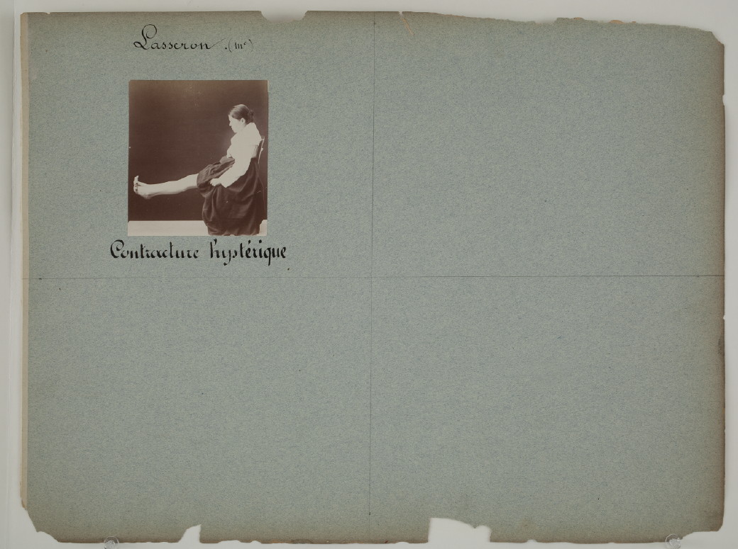 Fotó: Albert Londe: Charcot páciensei, Salpêtrière Kórház, Párizs, 1876-1880 © Bibliothèque Municipale de Toulouse