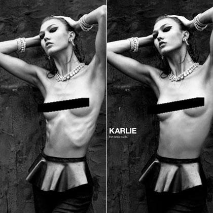 Ha még nem hallottátok volna, a bordák már nem menők, ahogy ezen a Karlie Kloss szupermodellről készült képen is látszik. Legyél elképesztően sovány, de ha lehet, csontok nélkül!