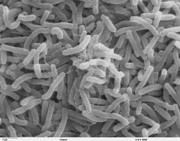 767px-Cholera_bacteria_SEM.jpg