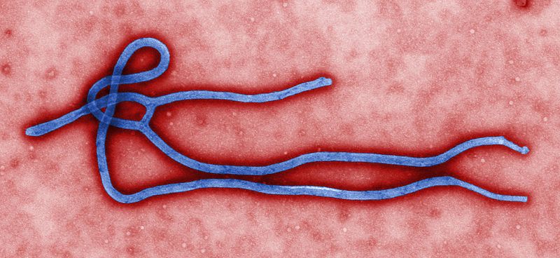 800px-Ebola_virus_virion.jpg