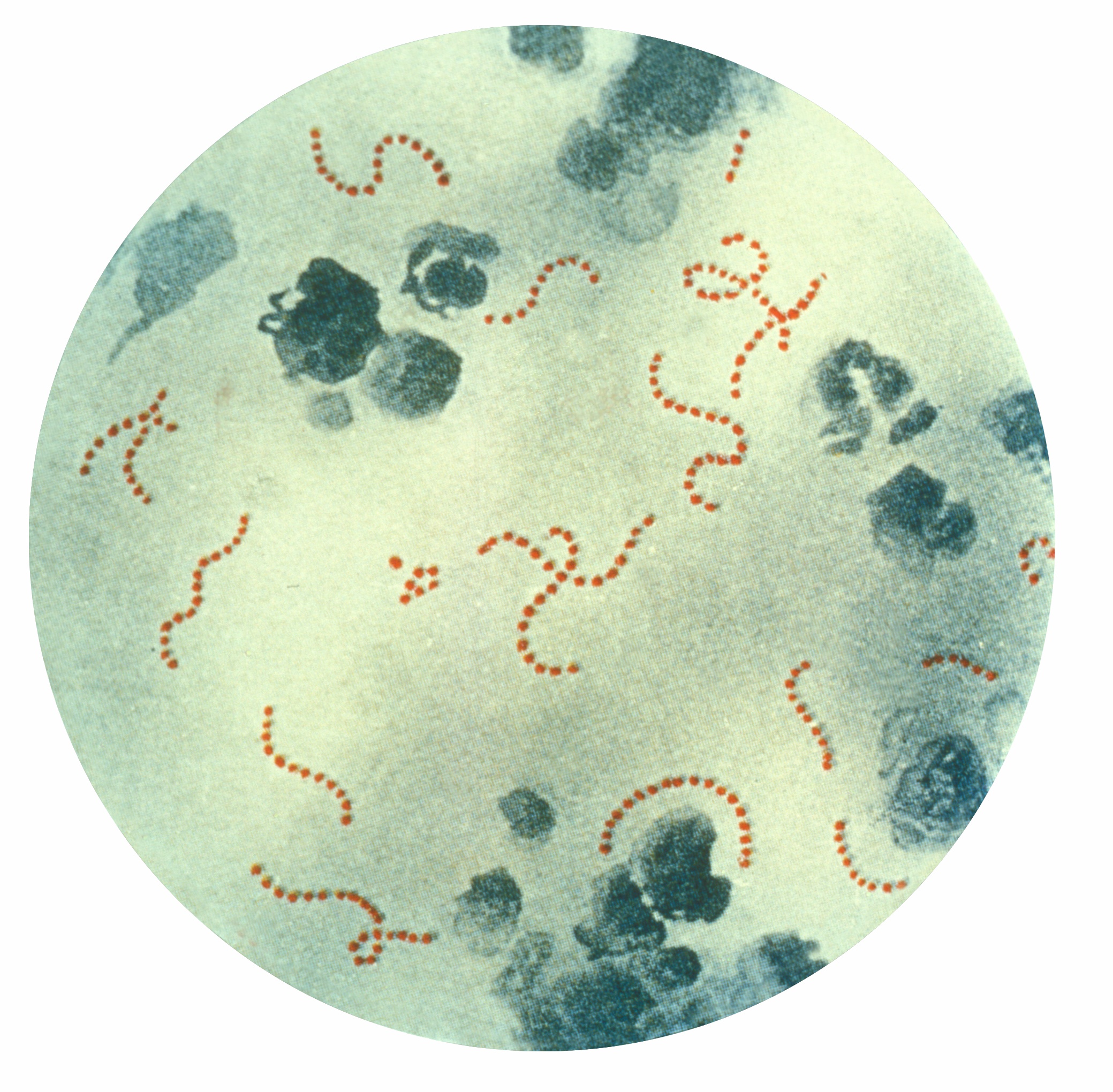 Streptococcus_pyogenes_01.jpg