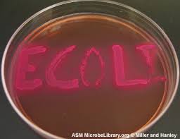 ecoli.jpg