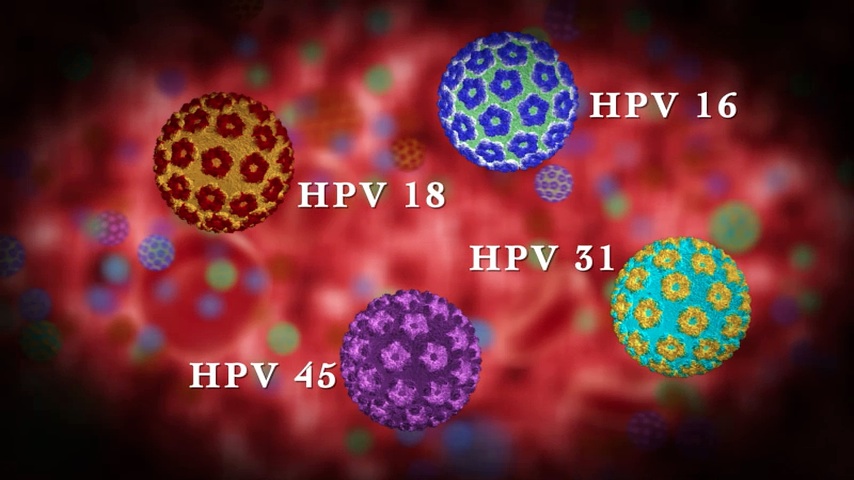 Méhnyakrák-szűrés, HPV, Rákszűrés Debrecen - Aranykéz