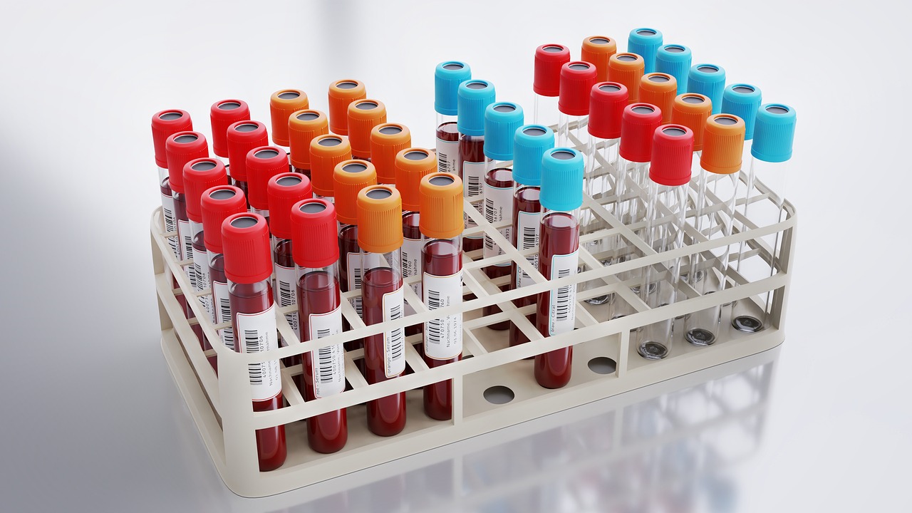 blood-collection-6574436_1280.jpg
