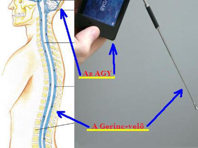 Az Agy, mint gondolat adó-vevő .......