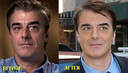 chris-noth-nose-job