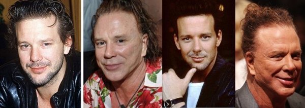 mickey-rourke-plastic-surgery (1)