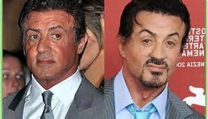 sylvester-stallone-plastic-surgery-before-and-after-2
