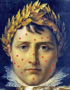 napoleon_beteg_lett.jpg