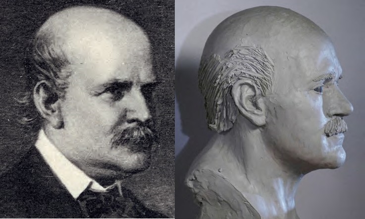 Semmelweis igazi arca