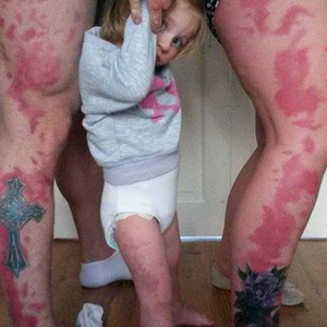 A szülők, akik lányuk miatt tűzfoltot tetováltattak magukra