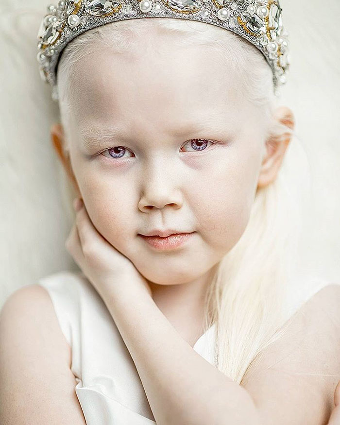 albino-girl-snow-white-nariyana-siberia-10.jpg
