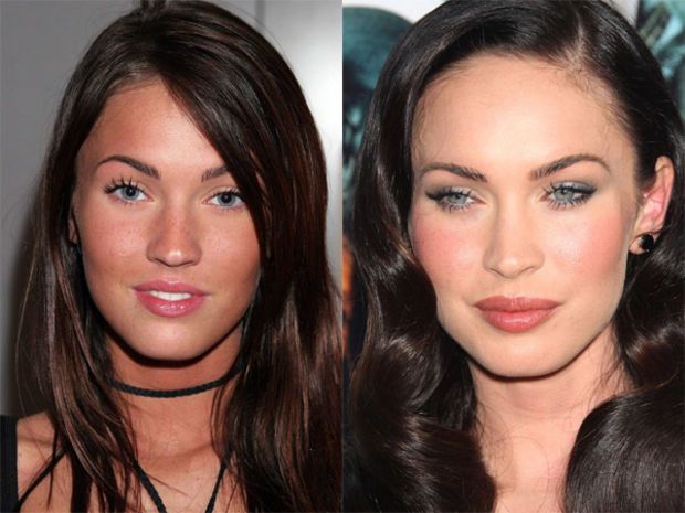 megan_fox_botox.jpeg