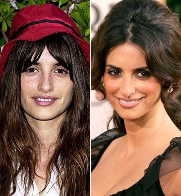 penelope_cruz_botox.jpeg