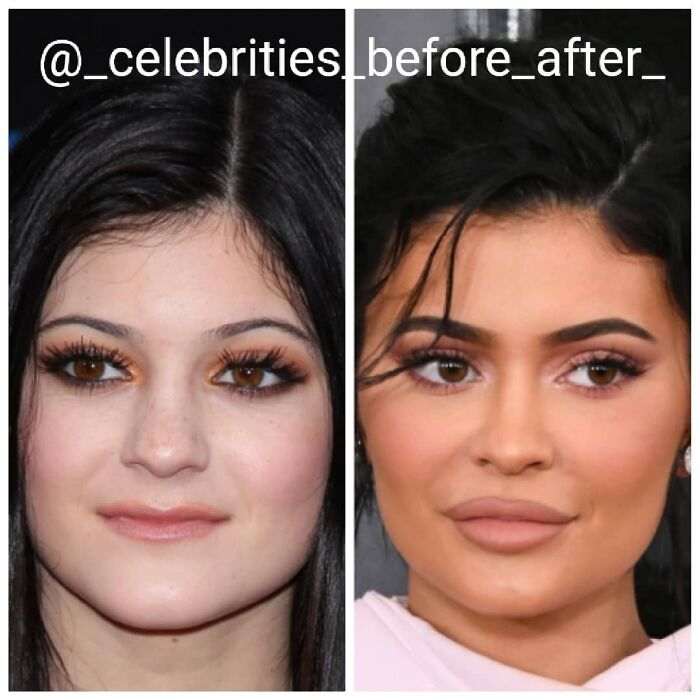 this-instagram-account-compares-the-before-and-after-of-celebrities-fame-61a090d5b0da0_700.jpg