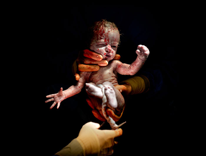 newborn-infant-photos-c-section-cesar-christian-berthelot-coverimage.jpg