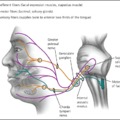 4. Trigeminus, facialis