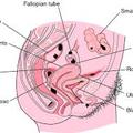 Rejtélyes betegség, az endometriózis